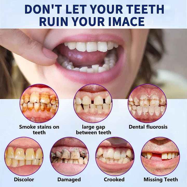 Rebolet | SmileFitPro™ – Lösung der neuen Generation: Flexible Vollprothese