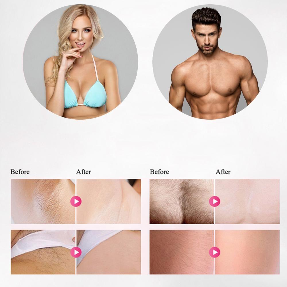Rebolet | Professioneller IPL Epilierer Laser-Haarentfernung