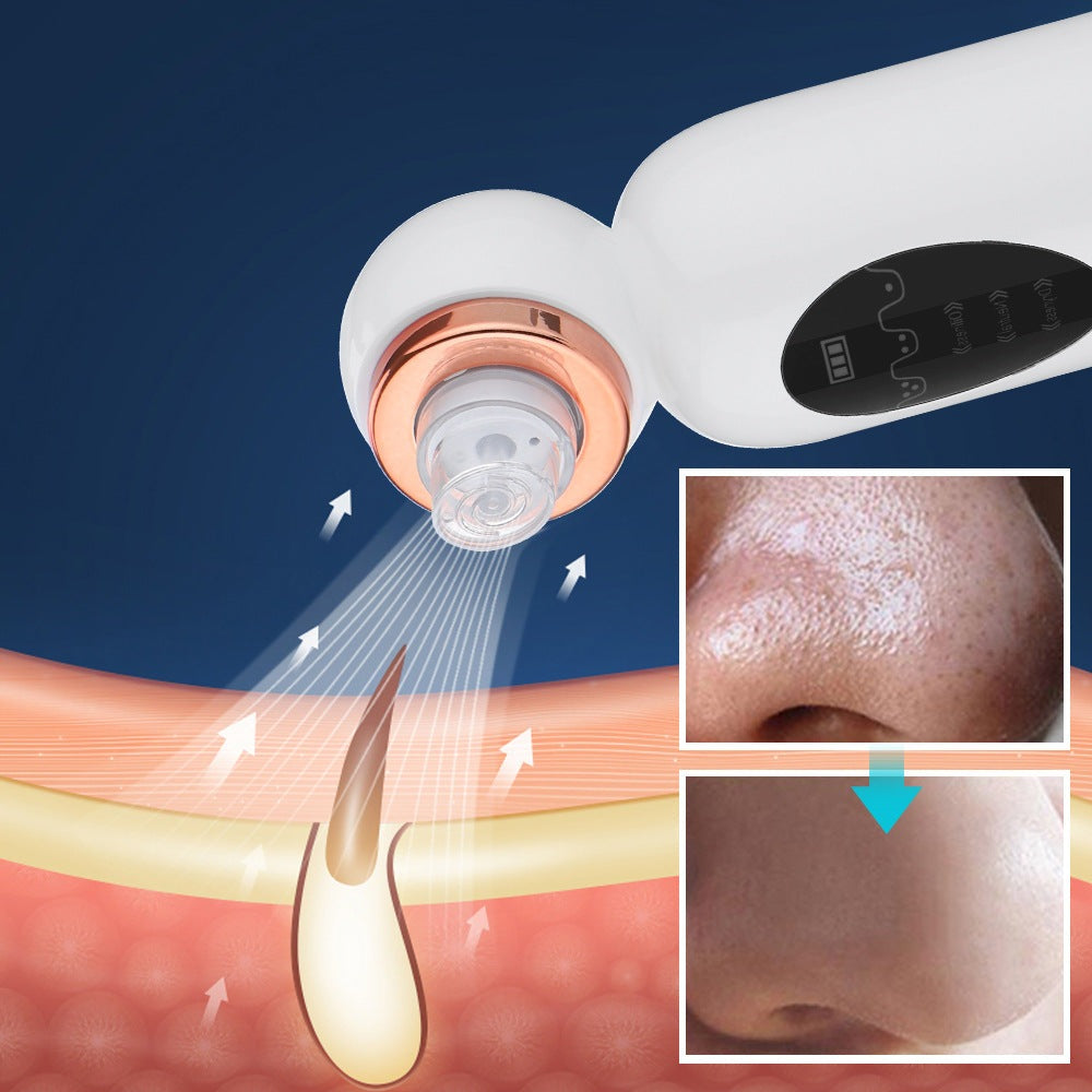 Rebolet | Hydrodermabrasion Mitesserentferner