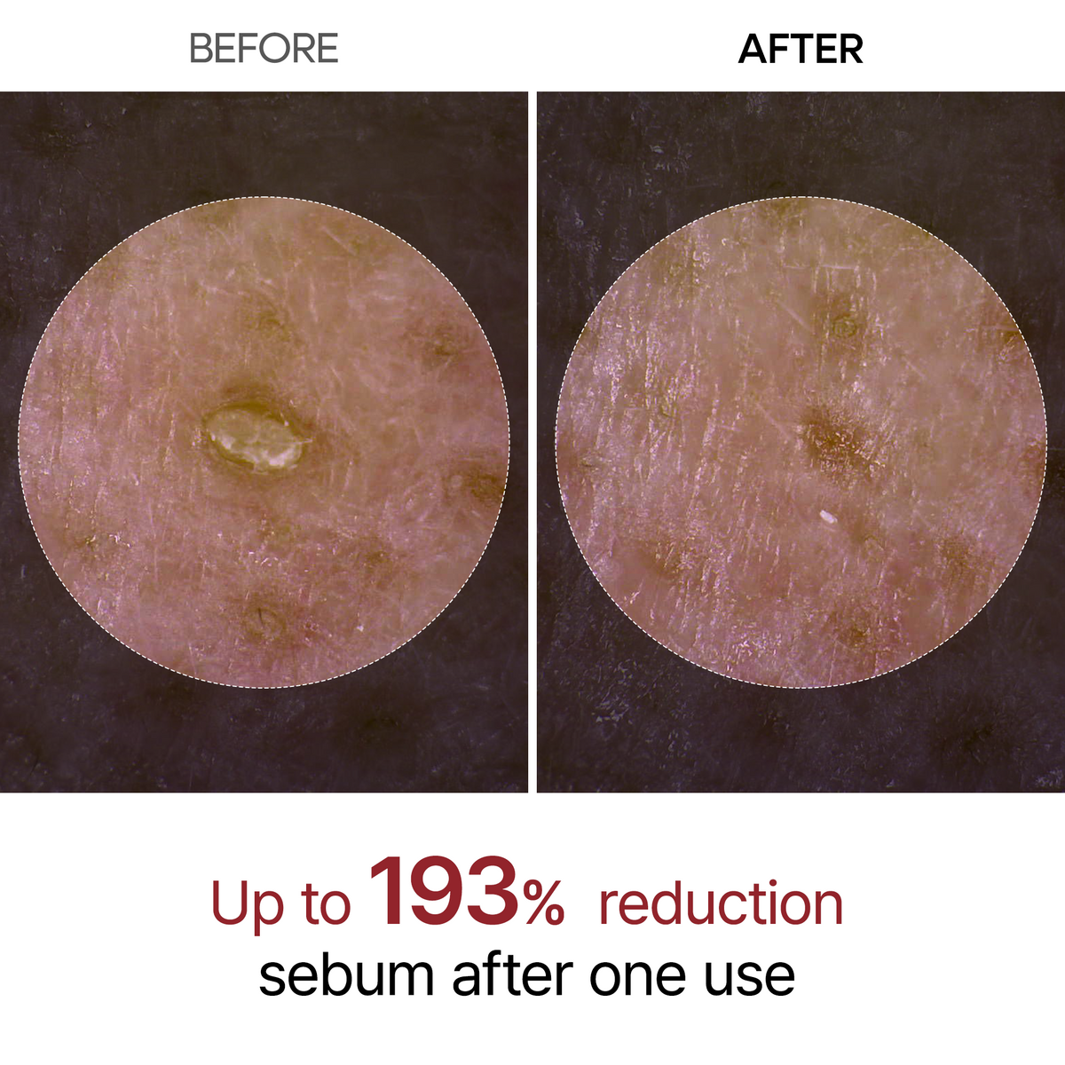Reiswasser Peeling Ampulle, sanft, für Gesicht & Körper, empfindliche Haut